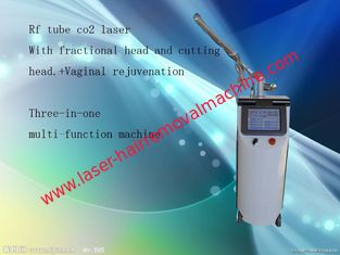 China Cinza fracionário do equipamento do laser do CO2 da remoção das verrugas + cor branca para o aperto da pele fornecedor